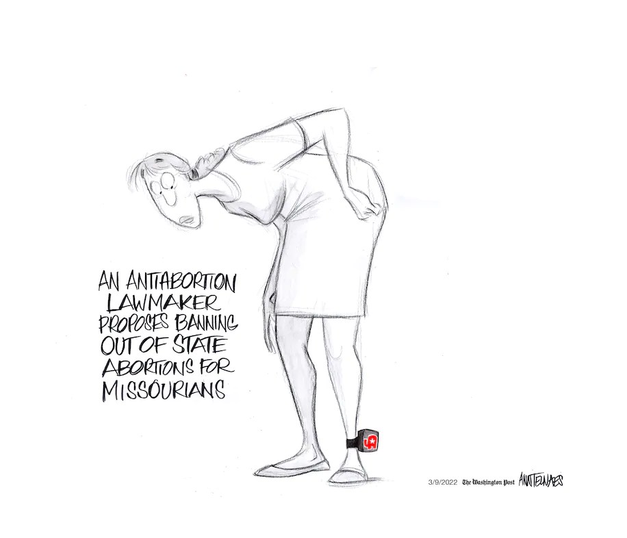 Ankle bracelt by gop