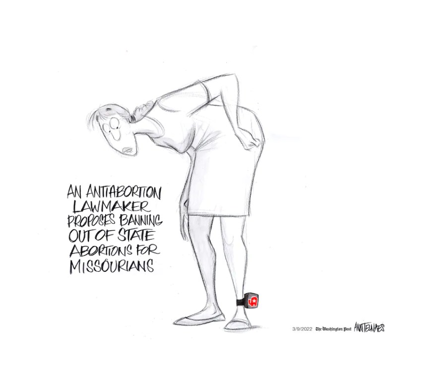 Ankle bracelt by gop